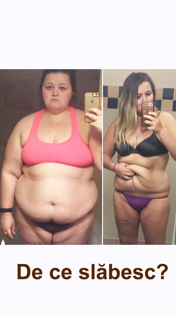 Cum poate o femeie obeză să piardă în greutate - Nutriție și pierdere în greutate cu PCOS