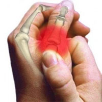tratamentul reumatismului gleznei ce înseamnă durerile articulare